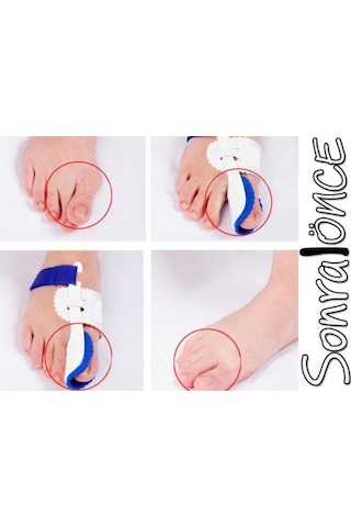 Büro Ev Ofis Personeli İçin Baş Parmak Kemik Düzeltici Gece Ateli Seti