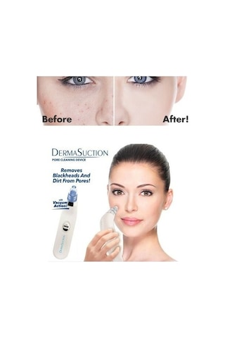 Derma Suction Vakumlu Siyah Nokta ve Yüz Temizleme Cihazı