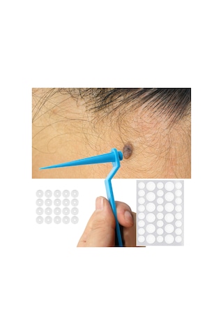 Teltree "ağrısız 2'li Et Beni Çıkarma Seti - 2mm-8mm Boyutlar İçin Lastik Bantlı" Çok Renkli