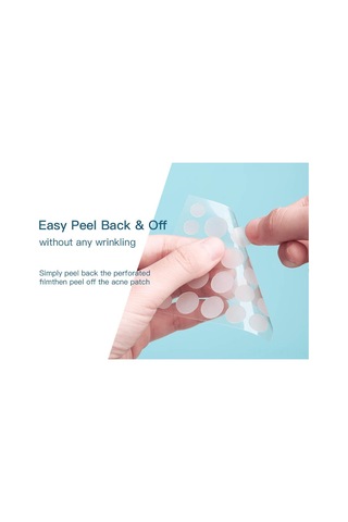 Youtek Sivilce Yama Seti - 144 Adet Hidrokolloid Yama & Çay Ağacı Yağı - Hassas Ciltler İçin Not: 113 Karakter Sınırına Uygun Olarak Optimize Edilmiştir