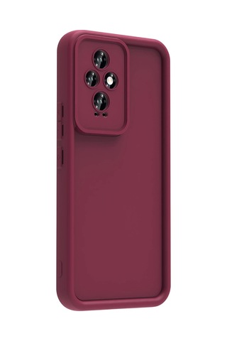 Honor 200 Kılıf Kamera Korumalı Zore Ananas Kapak