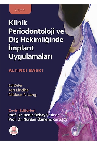 Klinik Periodontoloji Ve Diş Hekimliğinde İmplant Uygulamaları