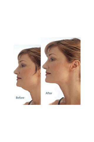 Büro Ev Ofis Personel Bakımı İçin Boyun Gıdı Toparlama Masaj Aleti Gri