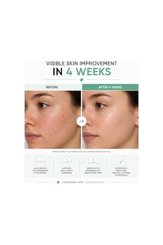 Azelaik Asit Serumu Niacinamide & Çinko İle 30ml