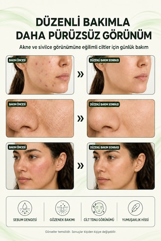 Organicsun Çay Ağacı Ve Propolisli Akne Ve Karşıtı Cilt Bakım Kremi 3 Adet X 50 Ml Siyah Nokta Ve Leke Görünümü Bakımı