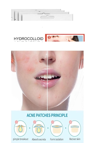 Tbyshop Akne Sivilce Bandı - Acne Patch