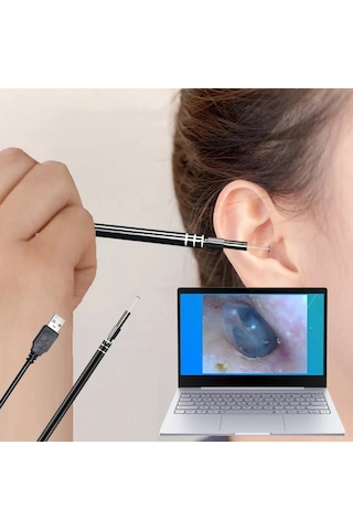 Kulak Muayene Endeskop Kamera 720P 3 in 1 Usb  Görsel Kulak Temiz