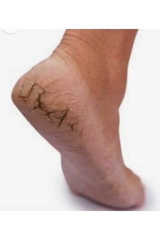 Cilton E Derm Özel Bakim Kremi 50 Ml