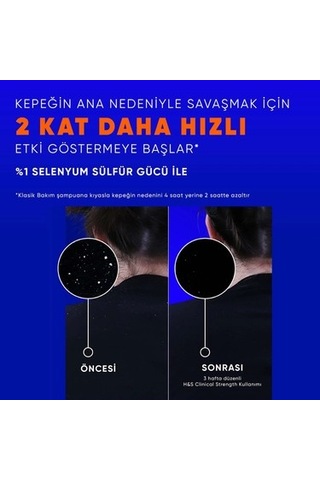 Kuru Saç Derisine Özel Şampuan - 350 Ml Derin Temizlik Normal