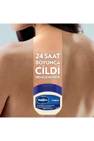 Nemlendirici Jel Original 100 Ml
