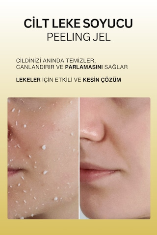 Dr. Wsay Leke Soyucu Peeling Jel 100 ML