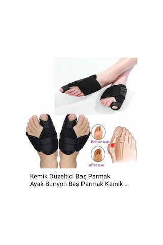 Ayak Kemik Düzeltici Halluks Valgus Gece Ateli