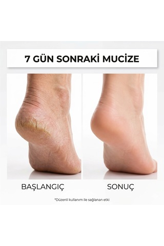 Dr. Bronos Bitkisel Ayak Bakım Kremi 150 ML