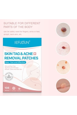 108 Adet Cilt Etiketi Akne Kaldırma Yamalar Ağrısız Pürüzsüz Temiz Temizle Cilt Hızlı Sökücü Sivilce Siğil Ana Yama Tedavisi Korur