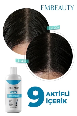 Embeauty Kolajen & Keratin Saç Dökülmesine Karşı Şampuan 400 ML