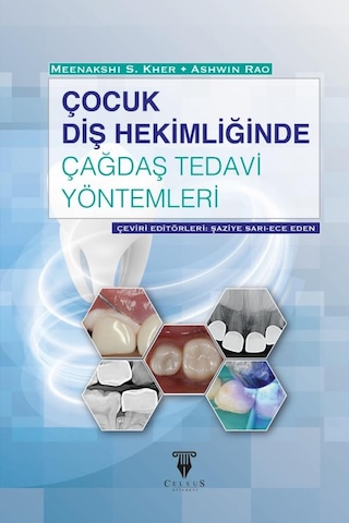 Çocuk Diş Hekimliğinde Çağdaş Tedavi Yöntemleri Çocuk Diş Hekimliğinde Çağdaş Tedavi Yöntemleri