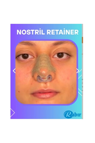 Burun Deliği Şekil + 3m Estetik Burun Ba...