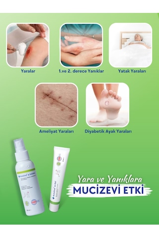 Actolind W Solutıon 100 ML & Actolind W Yara Jeli 50 ML