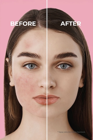 Sinoz Pink Touch Yüksek Koruyucu Ton Eşitleyici Pembe Yüz Güneş Kremi SPF50+ 50 ML