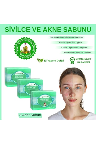 Organicsun Akne ve Sivilce Karşıtı Sabun 3 x 140 G