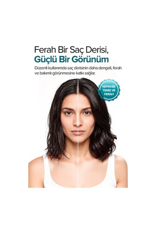 Scalpcare Saç Derisi Bakım Toniği 100 Ml