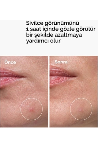 The Ordinary Sulfur 10% Powder-to-cream Concentrate
