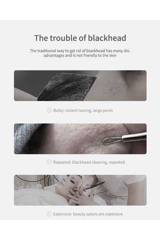 Samdoo Beyaz Elektrikli Siyah Nokta Çıkarıcı - 5 Farklı Prob Ve 3 Güç Modu İle Gözenek Temizleme, Ani Tüketim Ve Cilt Yenileme Cihazı Çok Renkli