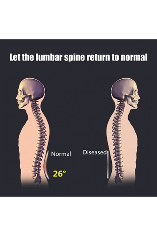 Kosona Evde Kullanıma Uygun Lomber Egzersiz Cihazı - Bel Ağrısı Alleviation, Dik Duruş Düzeltici Ve Masaj Fonksiyonu - 3 Seviye Ayarlanabilir Abs Malzeme Çok Renkli