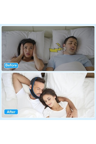 Vkemall Mavi Kenarlı Üçgen Tipi Uyku Çene Kayışı - Fiziksel Yardımcı, Konforlu Malzeme, Kolay Kullanim Ve Ayarlama