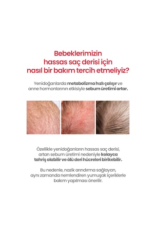 Bebeklere¥idoğanlara Özel Konak Karşıtı Saç Derisi Losyonu Atopalm Newborn Scalp Lotion