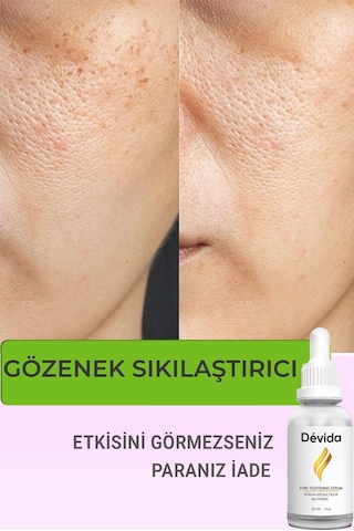 Devida Siyah Nokta Akne Gözenek Sıkılaştırıcı Vivo Series A210 30 ML