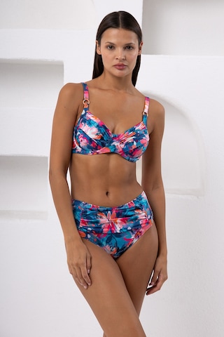 Lapıeno Balenli Büyük Beden Bikini Takım 4201 Garden