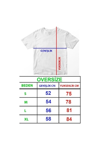 Startmore Motörhead Oversize T-shırt Siyah