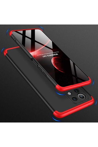 Xiaomi Mi 11 Lite Kilif Zore Kamera Korumali 360 Tam Koruma Ays 496999698