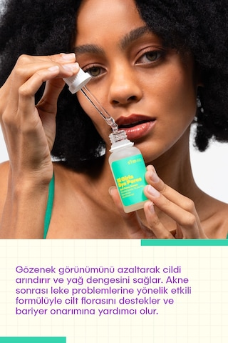 She Vec Hi Girls Bye Pores Akne ve Leke Karşıtı Bakım Serumu 30 ML