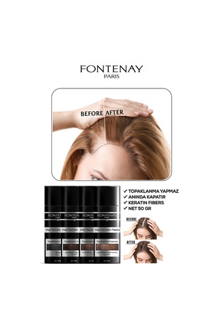 Fontenay Saç Dolgunlaştırıcı Keratin Fibers Koyu Kahve Topik Saç Tozu 50gr + Saç Spreyi 400ml 2'li Set 2 39000740