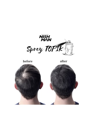 Nish Man Saç Dolgunlaştırıcı ve Seyrek Kapatıcı Root Touch Up Sprey 100 ML