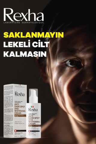 Antı Dark Spot And Whıtenıng Cream Leke Ve Beyazlatıcı Krem
