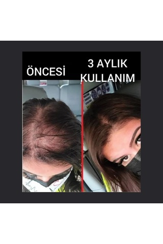 Saç Büyüme Serumu, Hair, 50 Ml, 10'lü Set - Hair