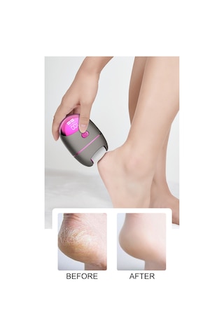 Moveevo Elektrikli Ayak Öğütücü Elektronik Ölü Deri Temizleme Ayak Bakım Aletleri Tırnak Sanatı Cilt Pürüzsüz Ayak