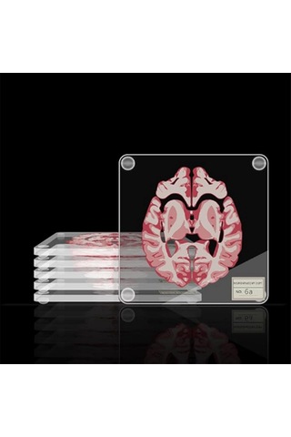 3d Organ Beyin Sanat Eseri Beyin Dilimleri Akrilik İçecekler Masa Altlığı Diğer