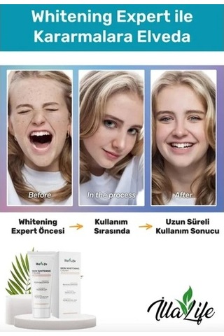 İlla Life Cilt Beyazlatıcı Leke Kremi 50 ML