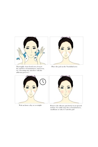 Vkemall Yenilikçi Silikon Yüz Maskesi: Nazolabial Kırışıklıklar Ve Dudak Çevresi İçin Etkili Çözüm