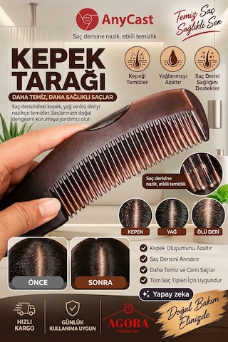 Anycast Kepek Tarağı, Yağ Ve Kir Giderici, Saç Derisine Masaj Yapan, Kendi Kendini Temizleyen, Unisex Tarak Saç Tarağı