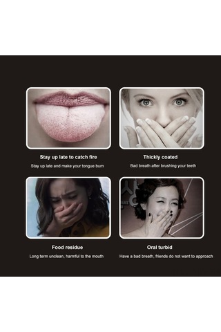 Moveevo Pas Kokusunu Önleyen 3'lü Paslanmaz Çelik Dil Kazıyıcı Seti - Ağız Hijyeni İçin