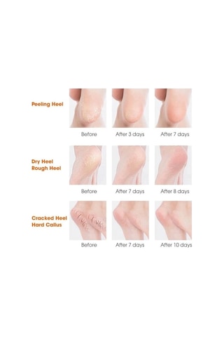 Silikon Topuk Nemlendirici Çorap Çok Renkli