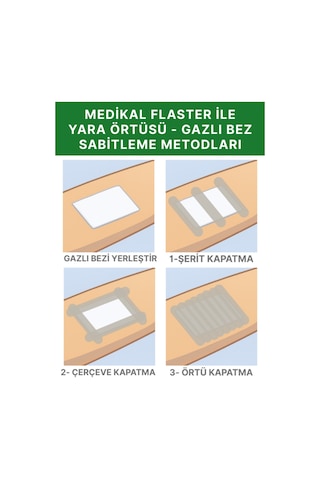Alban Medikal Sabitleme Flasteri İpek Bant 10 CM x 5 M