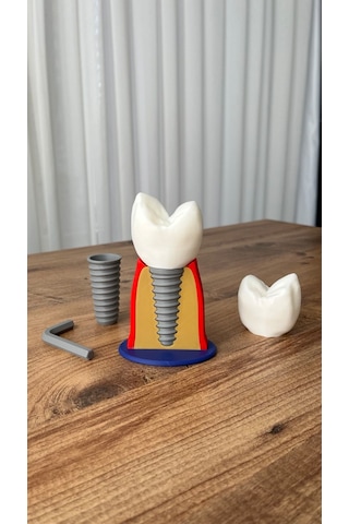 İmplant Modeli Diş Hekimliği Eğitici Model 13 CM