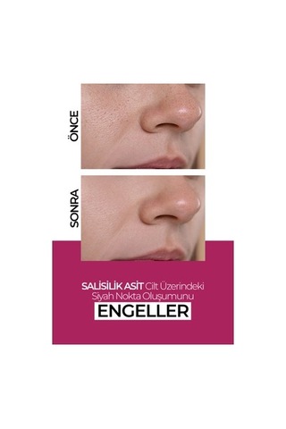 Günlük Kullanım İçin 50 Ml Nemlendirici Krem, Leke Karşıtı Ve Tüm Ciltler İçin