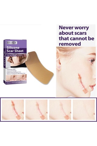 Dolıty Yanık İzleri Skar Yaması Çok Kullanımlı Yumuşak